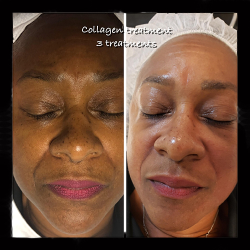 Before and After Treatment